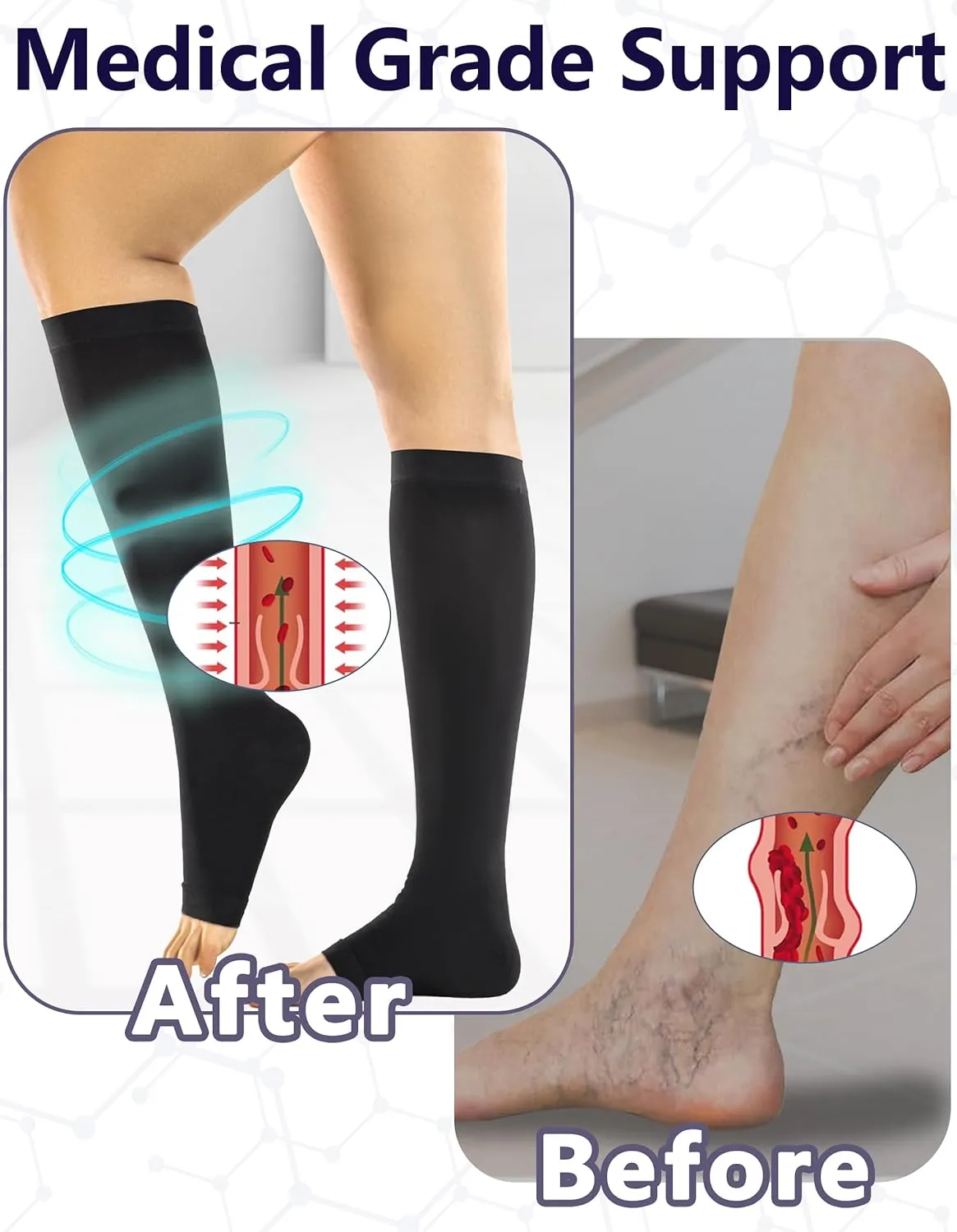  MD 2 Pairs Medical Compression Socks for Women & Men 20-30 mmHg, knee High Open Toe Stocking for Edema, Varicose Veins